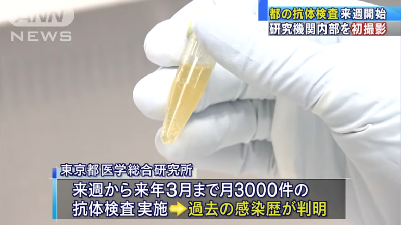 Isang research facility sa Tokyo, pinasilip sa kauna-unahang pagkakataon ang proyekto nito sa "antibody samples"