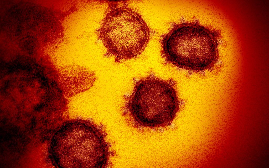 Coronavirus mutation, may 1.7 na beses na lakas at bilis umanong makahawa